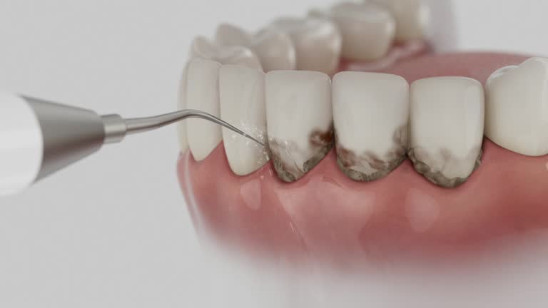 Reliable Tooth Extraction contractor in Coleman County County, TX by Dentist Open Now